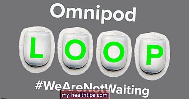 A DIY Omnipod Loop rendszer első benyomásai