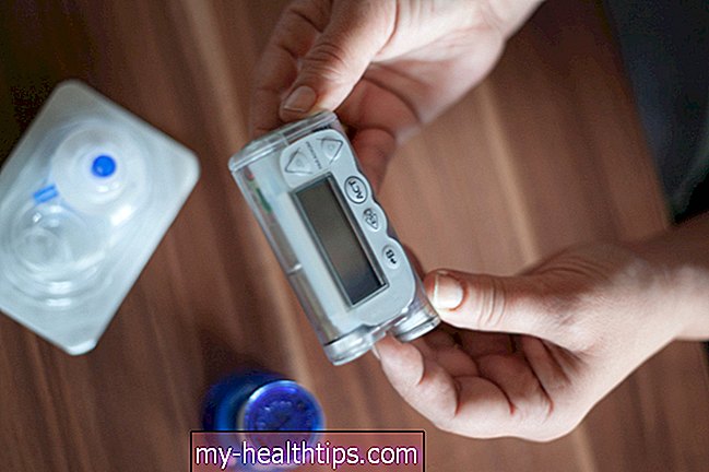 Hibaelhárítási tippek a gyakori inzulinpumpa- és CGM-problémákkal kapcsolatban