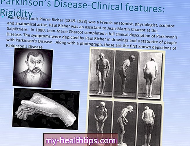 Jean (enfermedad de Parkinson)