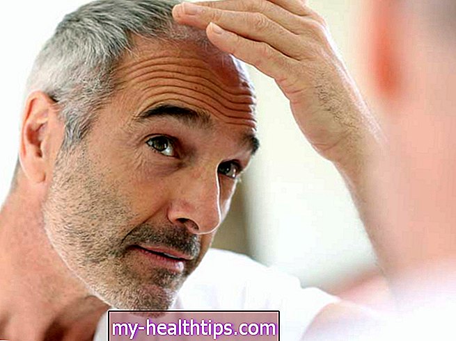 पुरुषों के लिए 17 बालों के झड़ने उपचार