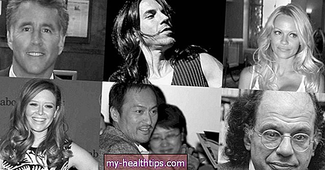 18 Hepatitis C-ben szenvedő hírességek