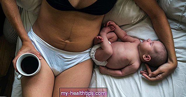 20 mødre bliver virkelige om deres post-baby krop (og vi taler ikke om vægt)