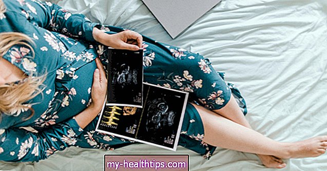20-tjedni ultrazvuk: sve što želite znati
