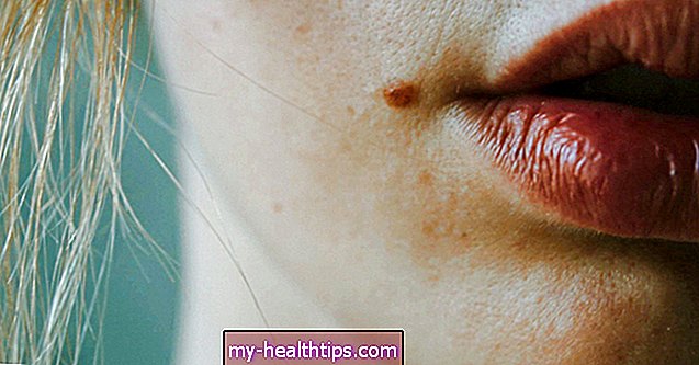4 módszer az egyenetlen ajkak kiegyenlítésére