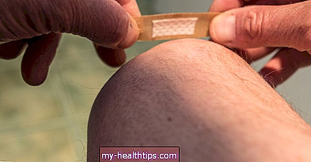 5 съвета за първа помощ при псориазис и повече начини за защита на кожата ви