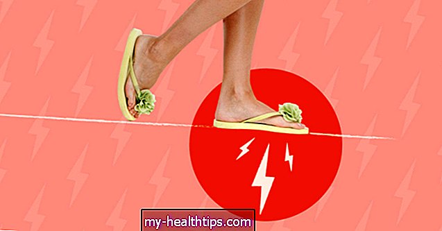 5 lijekova za bolove u ravnom stopalu uzrokovane vašim japankama