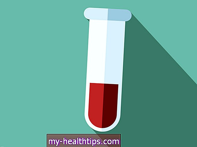 Vér-nátrium-teszt