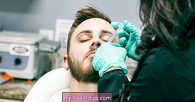 Botox for mænd: hvad man skal vide
