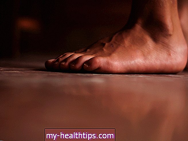 A cukorbetegség okozhat viszkető lábakat?