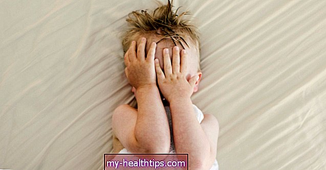 Årsager til din småbørs acne - og hvordan du kan behandle det