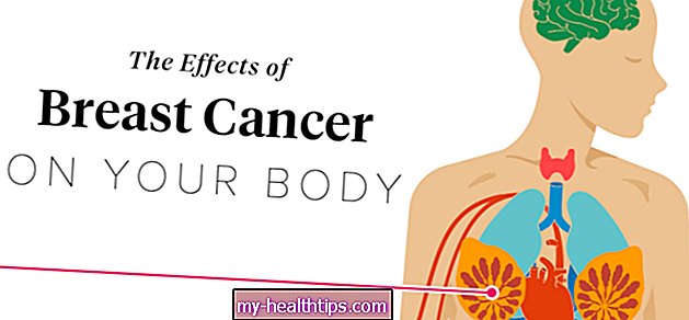 शरीर पर स्तन कैंसर के प्रभाव
