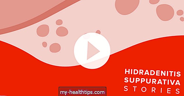 Hidradenitis Suppurativa történetek