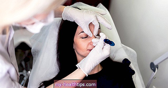 Hogyan segíthet a Botox megszabadulni a nyuszi vonalaktól