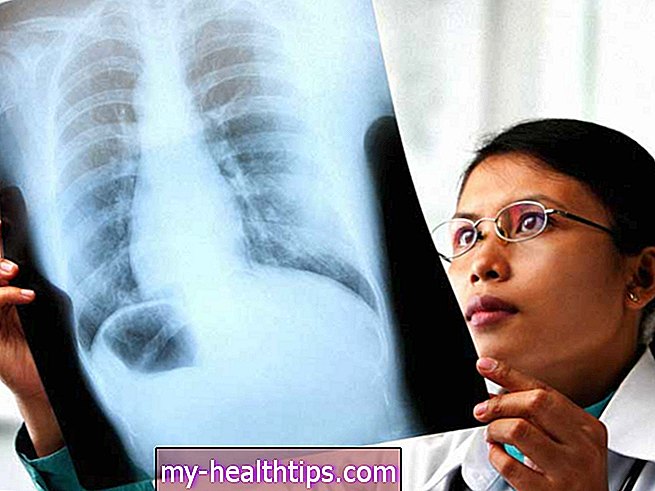 Hogyan segíthetnek a röntgensugarak a COPD diagnosztizálásában?