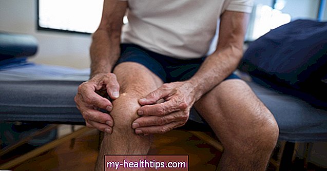 Како гихт може утицати на ваше колено