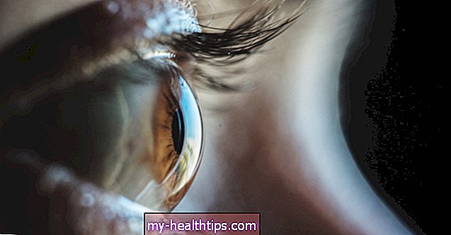 ग्रेव्स रोग आंखों को कैसे प्रभावित करता है