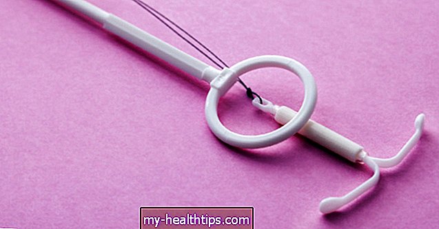 Hvordan fjernes en intrauterin enhed (IUD)?