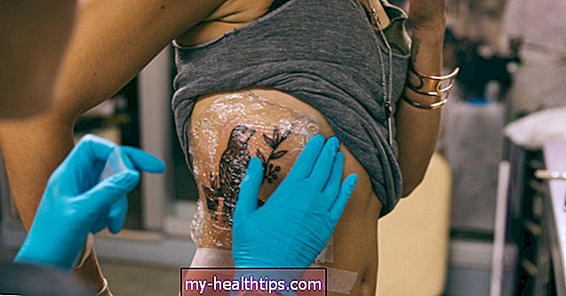Hogyan lehet azonosítani és kezelni a tetoválás allergiáját