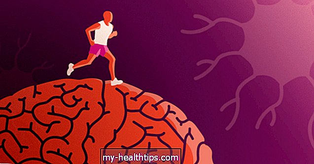 Hogyan lehet egészséges az agyad MS-vel: Útmutató