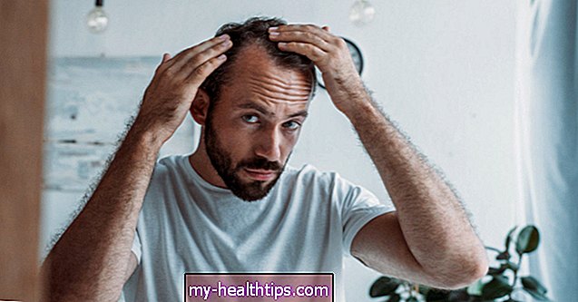 Как справиться с выпадением волос как побочным эффектом ВЗК