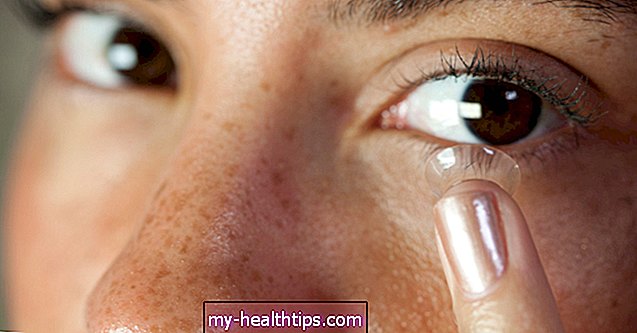 Sådan udtages kontaktlinser