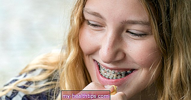 Hogyan kezeljük a duzzadt ínyt fogszabályozóval
