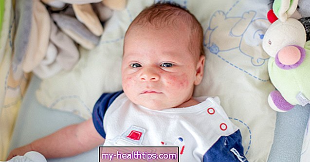 Identifikation og diagnosticering af et virusudslæt hos babyer