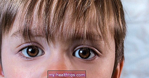 A rózsaszín szem azonosítása és kezelése kisgyermekeknél