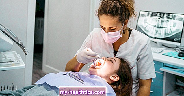 Van-e mód a fogak egyengetésére fogszabályozó nélkül?