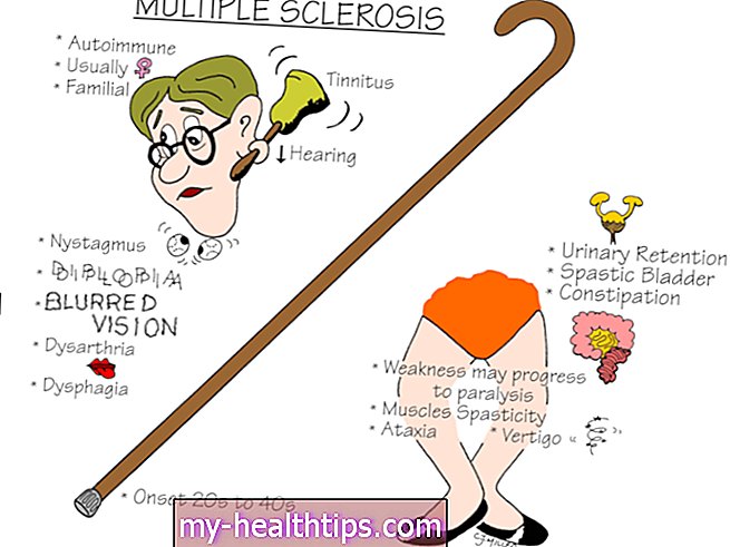 A sclerosis multiplex alapjai