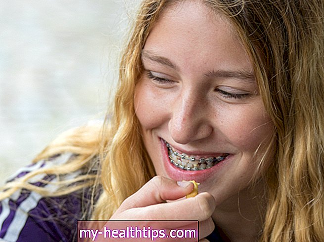 Ortodontisk hovedbeklædning: Hjælper det med at forbedre tænderne?