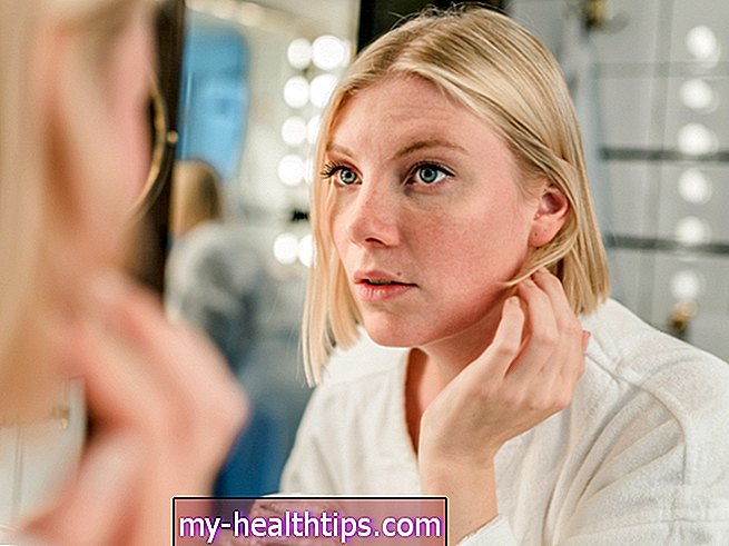 Megelőző botox: elhárítja a ráncokat?