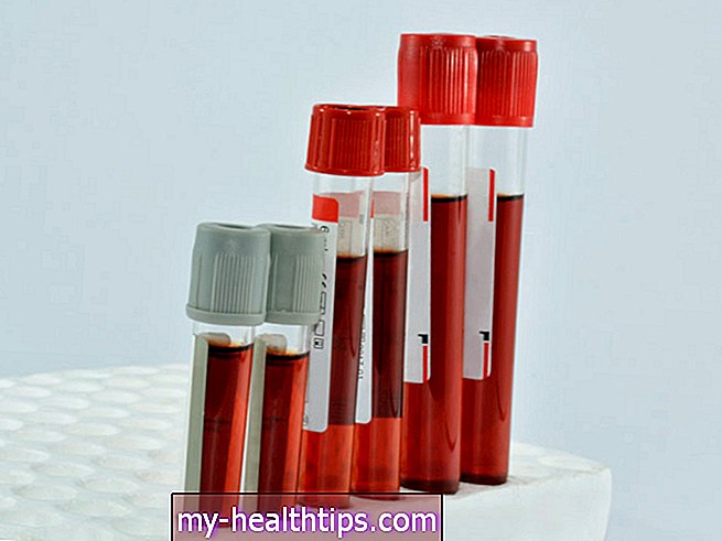 Serum Herpes Simplex Antistoffer Test
