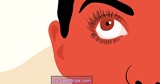 A száraz szemek kezeléséhez vény nélkül kapható opciók