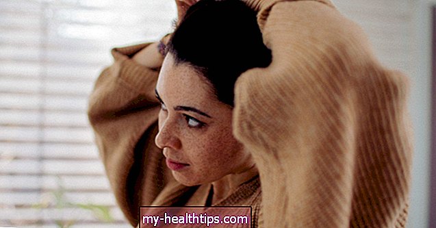 A szeborreás dermatitis és a hajhullás kapcsolata