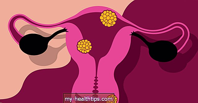 Tips til behandling og forebyggelse af bakteriel vaginose