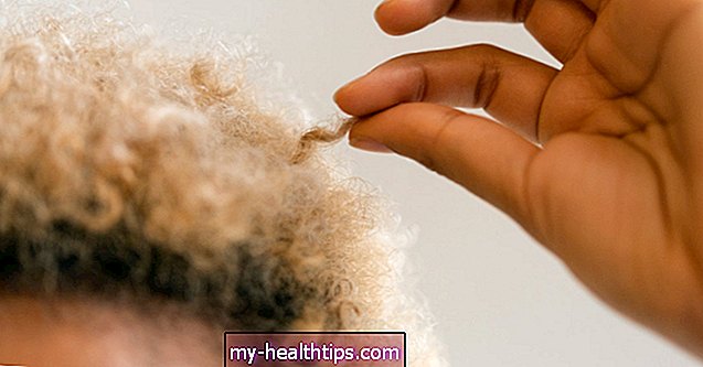 Разбиране на трихотиломанията: желанието да издърпате косата си