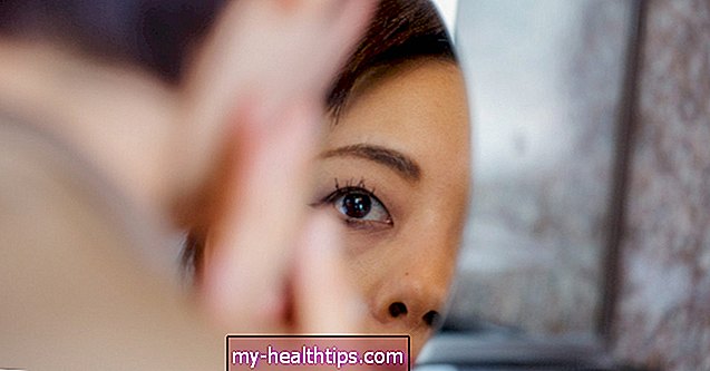 Negydomos lėtinės sausų akių komplikacijos ir rizika