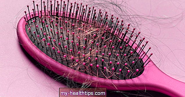¿Qué causa la caída del cabello después de la cirugía?