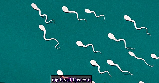Mi okozza az alacsony spermiumszámot és hogyan kezelik?
