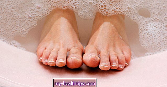 क्या आपके पैर छीलने के कारण हो सकता है?