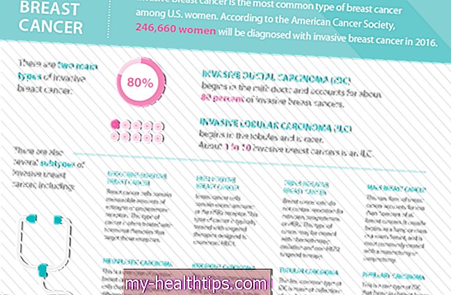 स्तन कैंसर के बारे में हर महिला को क्या पता होना चाहिए