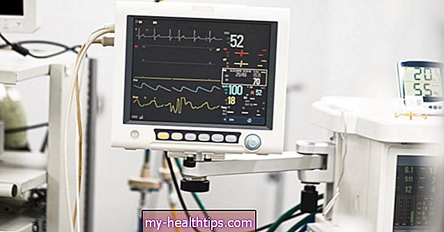 ¿Qué le sucede a su frecuencia cardíaca durante un ataque cardíaco?