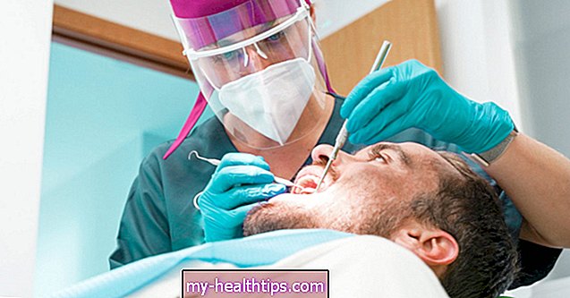 Mi a csonttüske a száj egészségében, és hogyan kezelik?