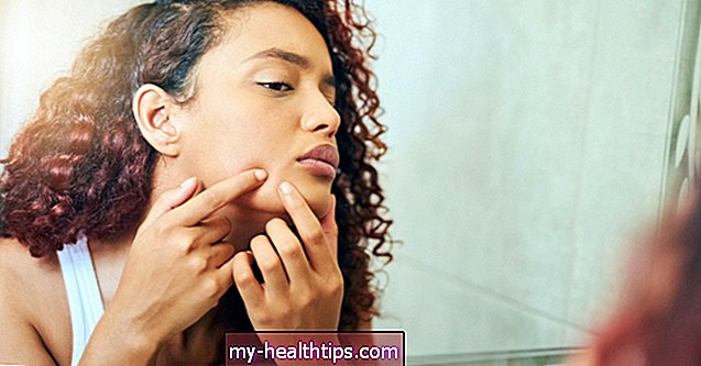 Hvad er Pimple Pus, og hvordan man behandler og forhindrer det