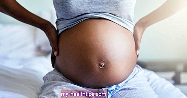 Какво трябва да знаете за пъпната херния по време и след бременност
