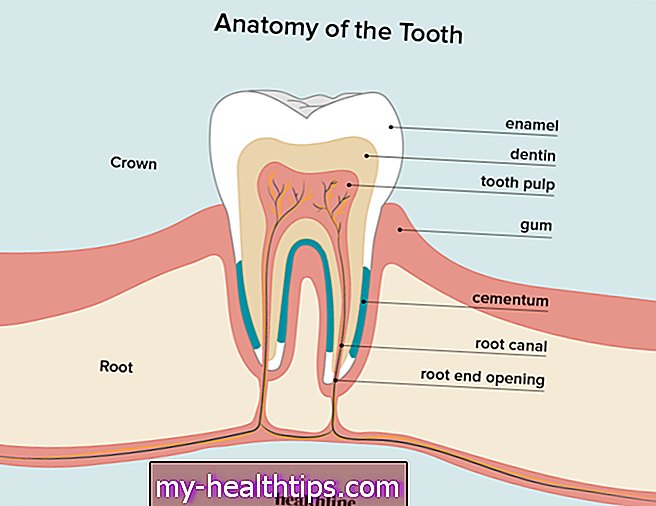 Ką reikia žinoti apie dantų minkštimą