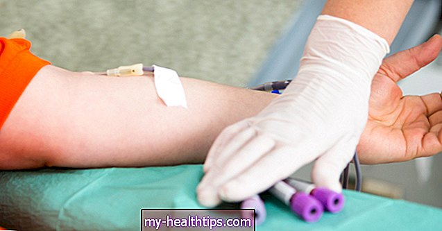 Koks yra normalus kraujo pH ir kas jį keičia?