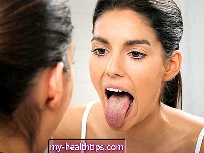 Hvorfor bløder min tunge?