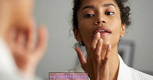 Может ли дефицит витаминов вызвать потрескавшиеся губы?